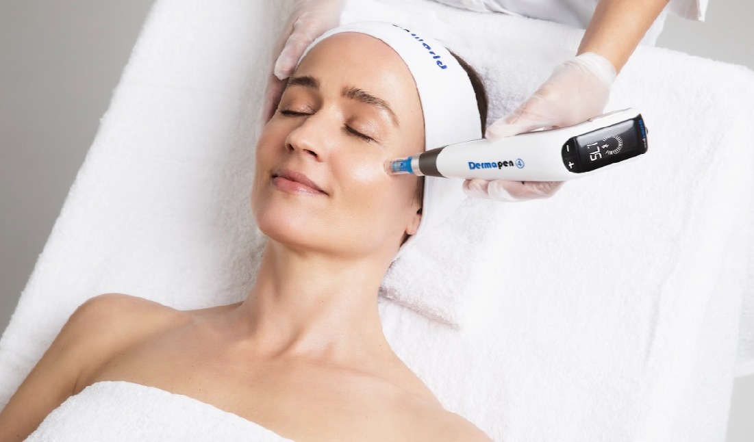 Dermapen 4 - Precizna stimulacija za obnovu kože