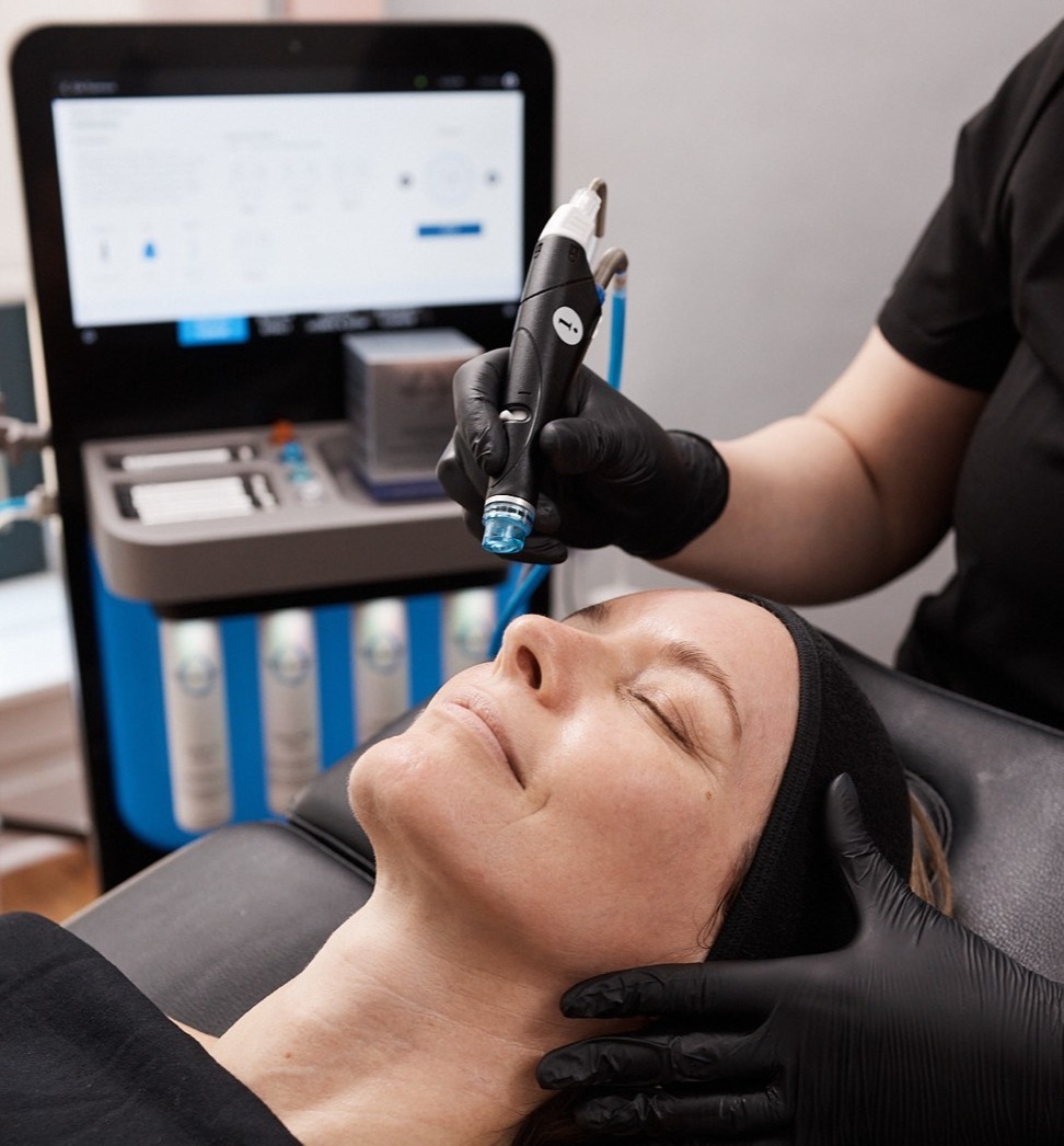 Hydrafacial  – Inovacija u njezi kože